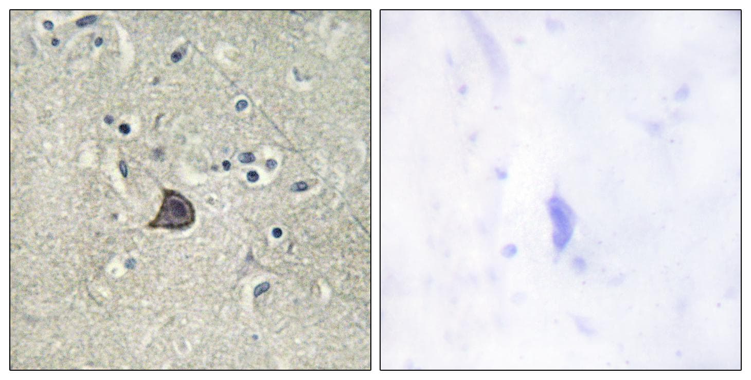 PLCB3 Antibody (phospho-Ser537)