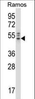 GRB4 / NCK2 Antibody (aa63-92)