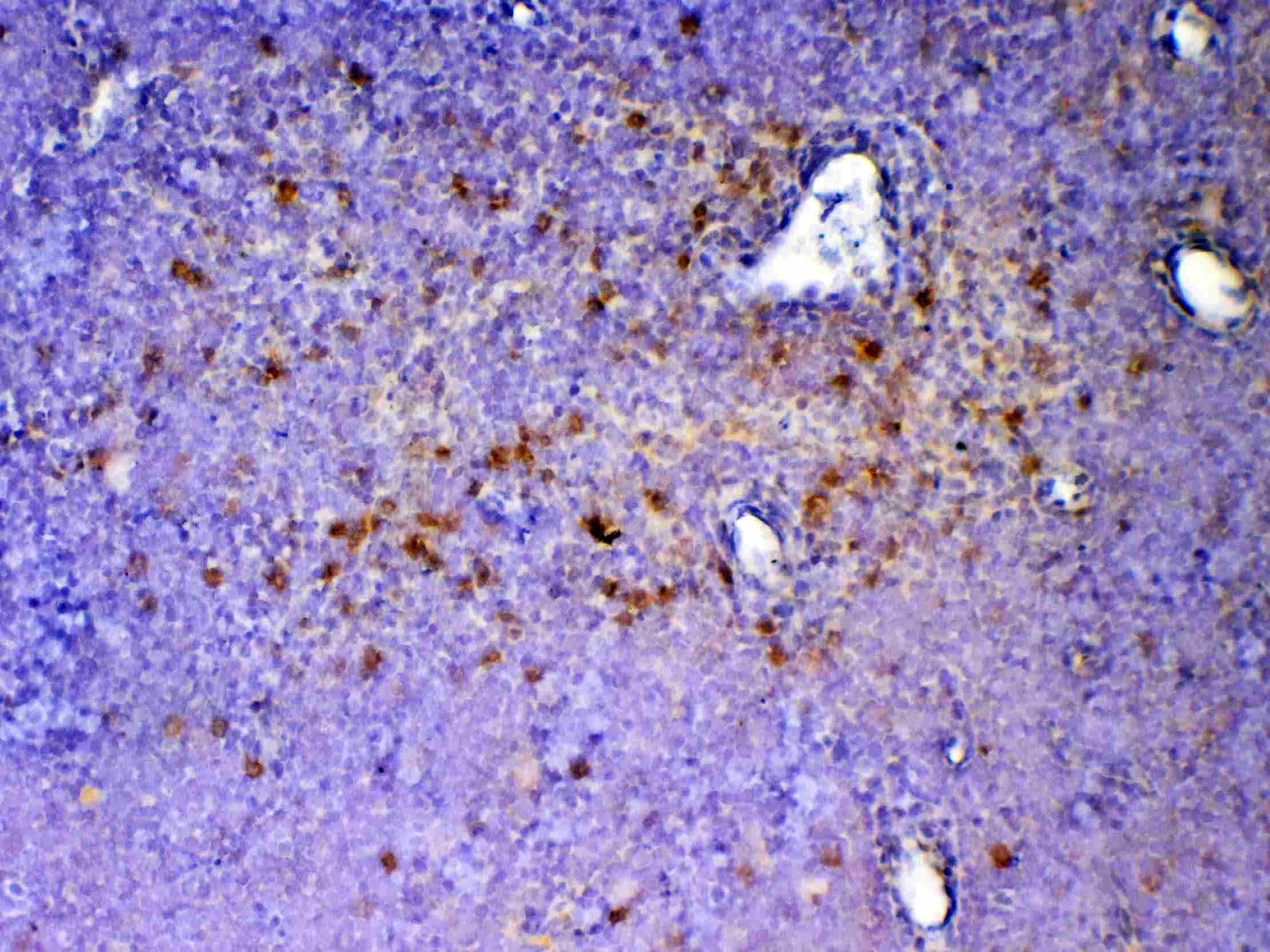 ICOS / CD278 Antibody