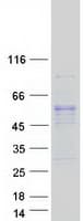 Human LRRC74A Protein (Recombinant Myc-DDK (Flag))