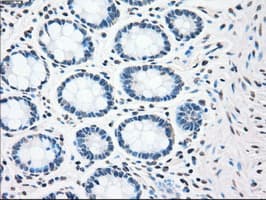 Monoclonal Mouse anti-Human CHEK2 / CHK2 Antibody (clone OTI5C7, IHC, WB)