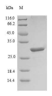 Cow LGALS1 / Galectin 1 Protein (Recombinant 6His-SUMO, N-terminus)