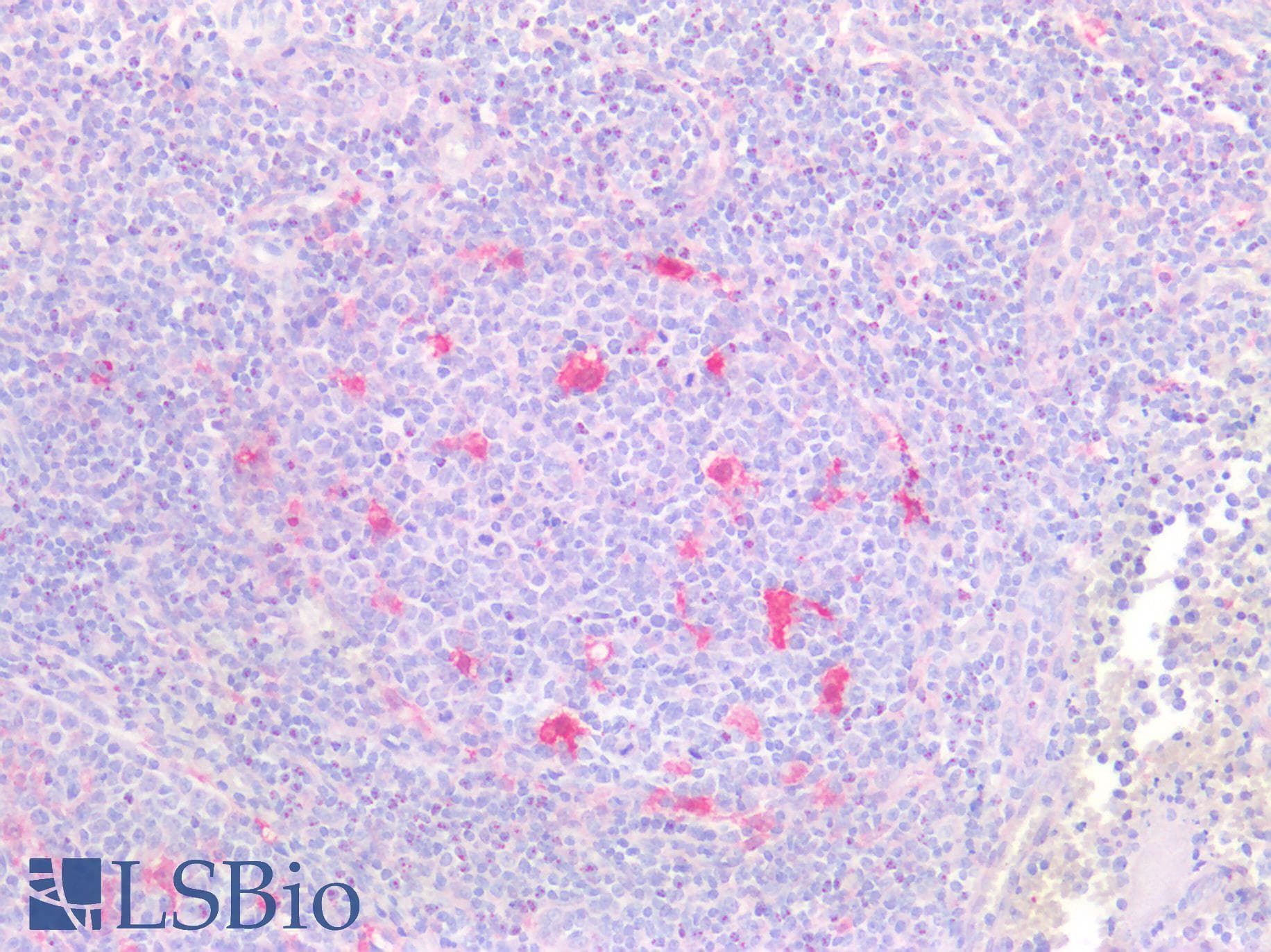 PathPlus™ TMIGD2 Antibody (clone 8G1)