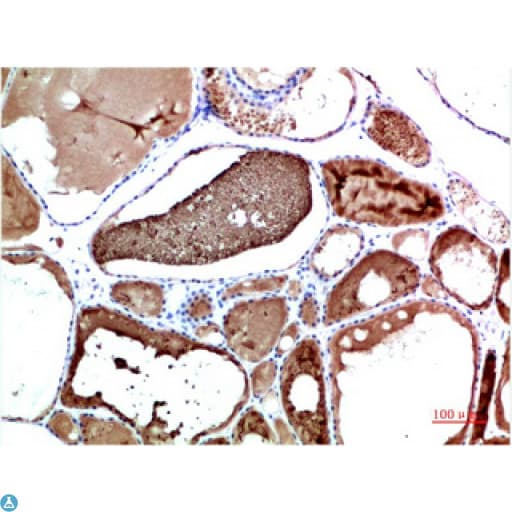 TTR / Transthyretin Antibody