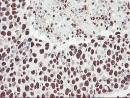 NONO / P54NRB Antibody (clone OTI2C9)