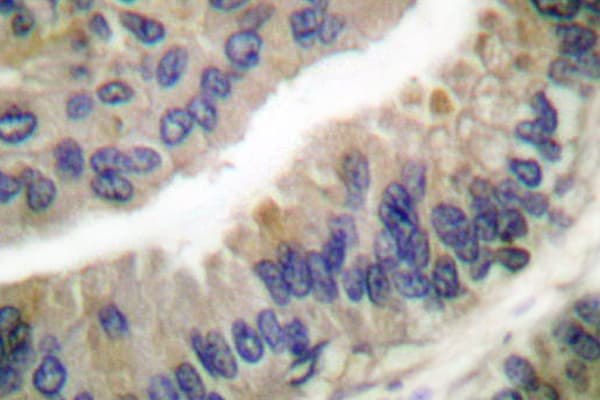 HSP90AA / HSP90 Alpha Antibody (Pro717)