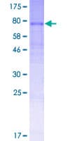 Human SLC35D3 / FRCL1 Protein (Recombinant GST)