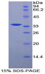 Mouse RFTN1 / Raftlin Protein (Recombinant His-T7)