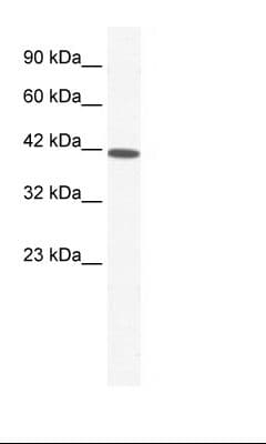SOX11 Antibody (N-Terminus)