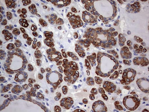 Monoclonal Mouse anti-Human KRT24 / Keratin 24 Antibody (clone OTI4E8, aa139-397, IHC, WB)