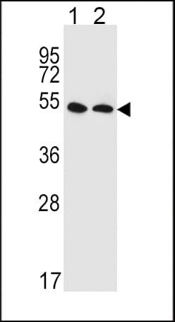 IHC-plus™ SLC47A1 / MATE1 Antibody (aa492-519)