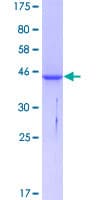 Human ACP1 / Acid Phosphatase Protein (Recombinant GST)