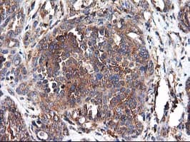 HARS2 Antibody (clone OTI3F1)