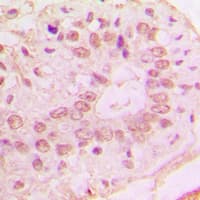 Polyclonal Rabbit anti-Human CDKN2B / p15 INK4b Antibody (C-Terminus, IHC, IF, WB)