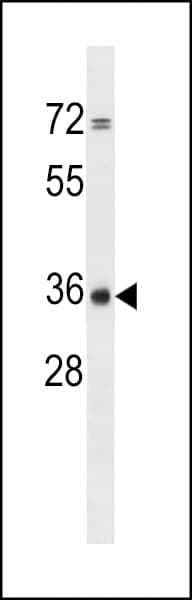 CPPED1 Antibody (aa211-237)