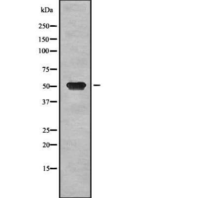 DAPK3 / ZIP Kinase Antibody