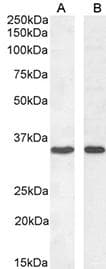 Polyclonal Rabbit anti-Human C5AR2 / GPR77 / C5L2 Antibody (WB)