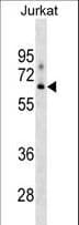 XYLB Antibody (aa18-47)