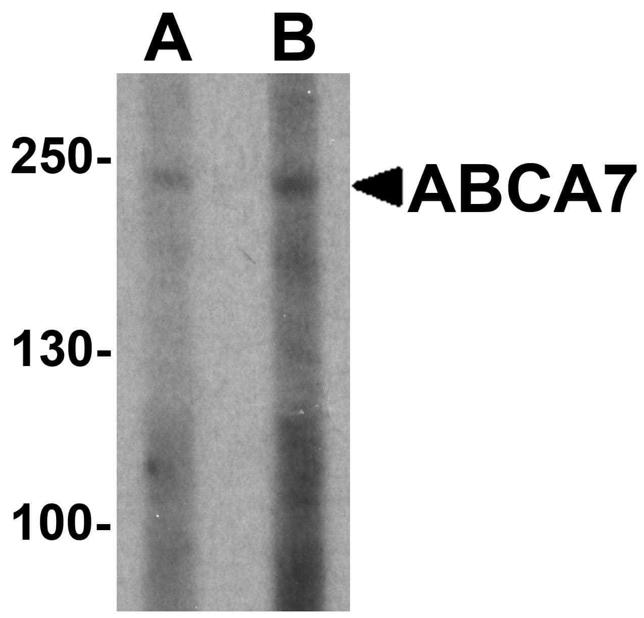 ABCA1 Antibody