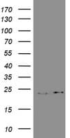 IHC-plus™ Monoclonal Mouse anti-Human GSTP1 / GST Pi Antibody (clone 10H1, IHC, WB)