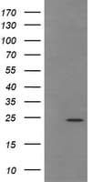 Monoclonal Mouse anti-Human TRAPPC4 / Synbindin Antibody (clone OTI2G8, IHC, WB)