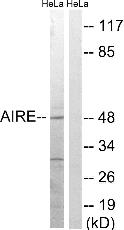 AIRE Antibody (p156)