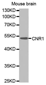 IHC-plus™ Polyclonal Rabbit anti-Human CNR1 / CB1 Antibody (IHC, WB)