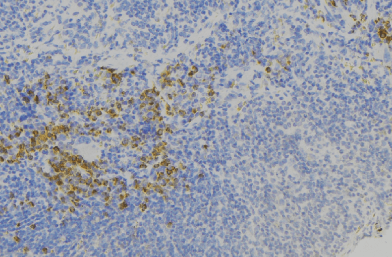 S100A9 / MRP14 Antibody
