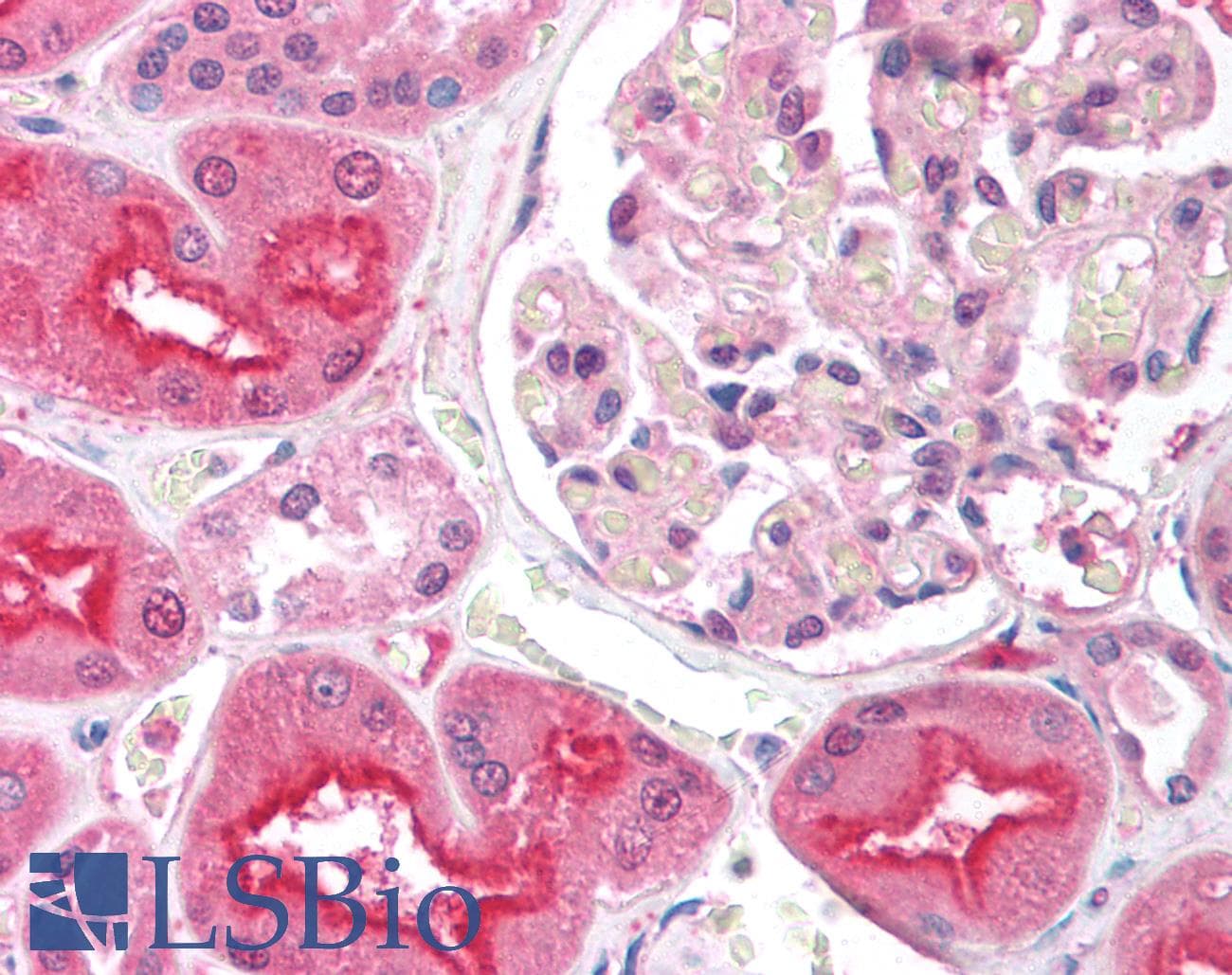 IHC-plus™ Polyclonal Rabbit anti-Human EIF2AK2 / PKR Antibody (IHC, WB)