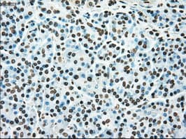 Monoclonal Mouse anti-Human TYRO3 Antibody (clone OTI2G2, IHC, WB)