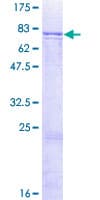 Human ADCK1 Protein (Recombinant GST)