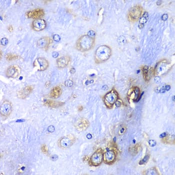 RPS3A / Ribosomal Protein S3A Antibody