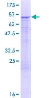 Human IQCB1 Protein (Recombinant GST)