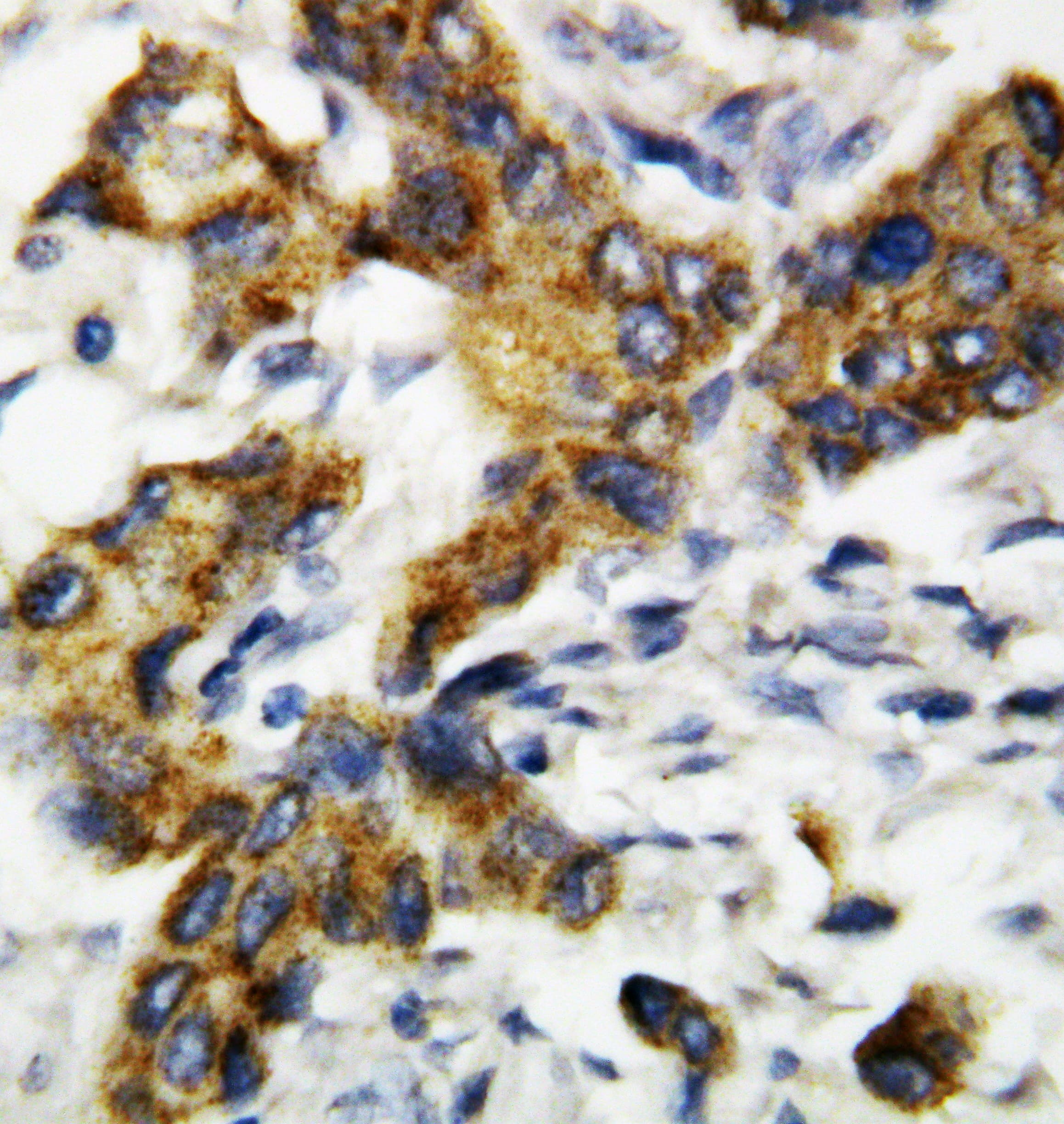 Polyclonal Rabbit anti-Human BAK1 / BAK Antibody (aa74-95, IHC, WB)