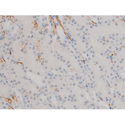 AP-1 / JUND Antibody (phospho-Ser255)