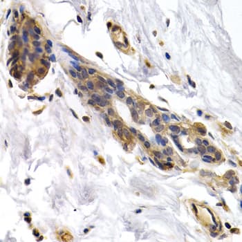 PKLR Antibody