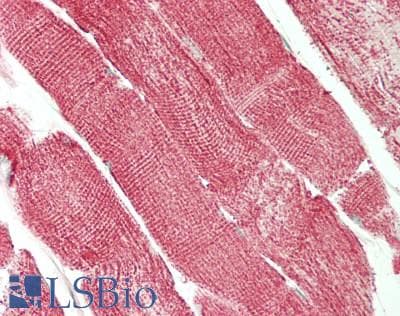 IHC-plus™ NDUFA13 / GRIM19 Antibody