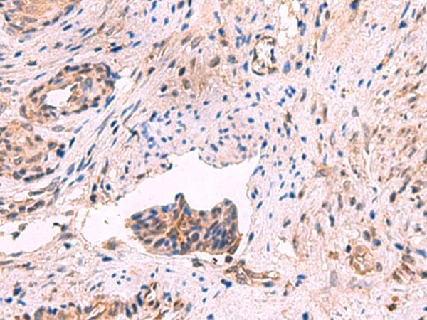 Polyclonal Rabbit anti-Human GSPT2 Antibody (IHC, WB)