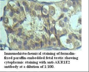 AKR1E2 Antibody