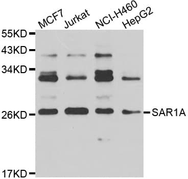 Polyclonal Rabbit anti-Human SAR1A / SAR1 Antibody (IHC, WB)