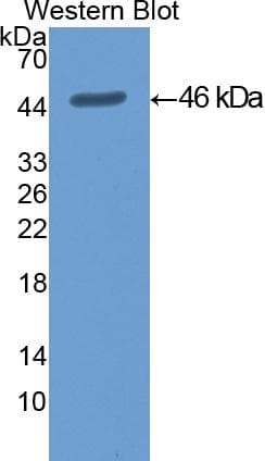 KRT19 / CK19 / Cytokeratin 19 Antibody (aa1-403)