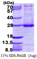 Human ARL4A / ARL4 Protein (Recombinant His)