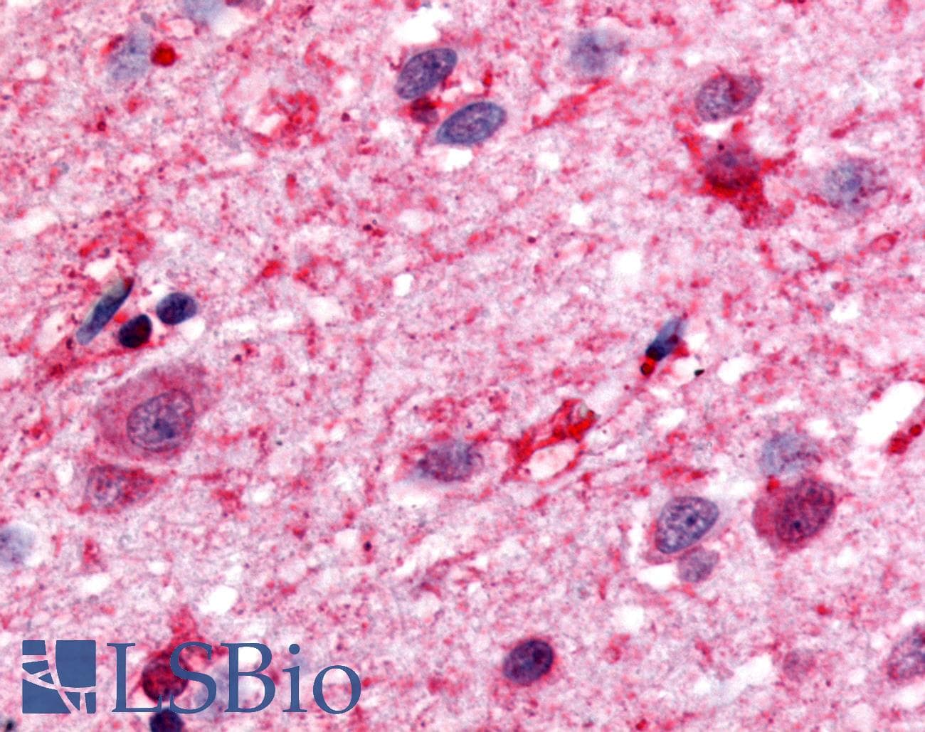 PathPlus™ DRD1 / Dopamine Receptor D1 Antibody (C-Terminus)