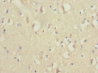 Polyclonal Rabbit anti-Human NDUFV1 Antibody (IHC, WB)