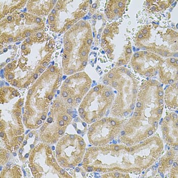 Polyclonal Rabbit anti-Human MMP10 Antibody (IHC, WB)