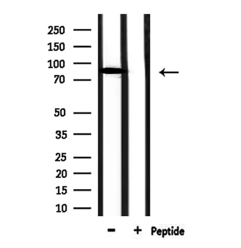 CFB / Complement Factor B Antibody