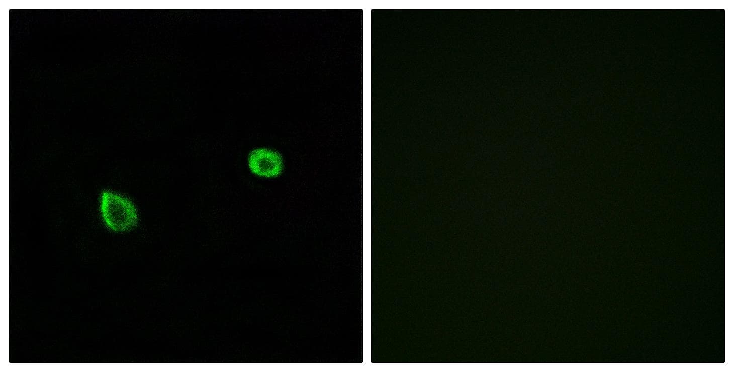 Polyclonal Rabbit anti-Human ERN2 Antibody (IHC, IF)