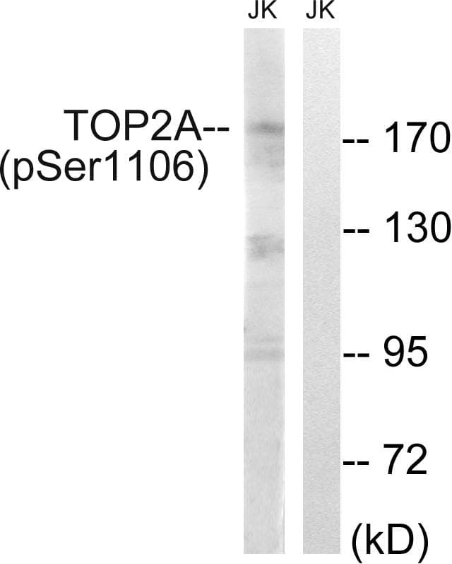 TOP2A / Topoisomerase II Alpha Antibody (phospho-Ser1106)