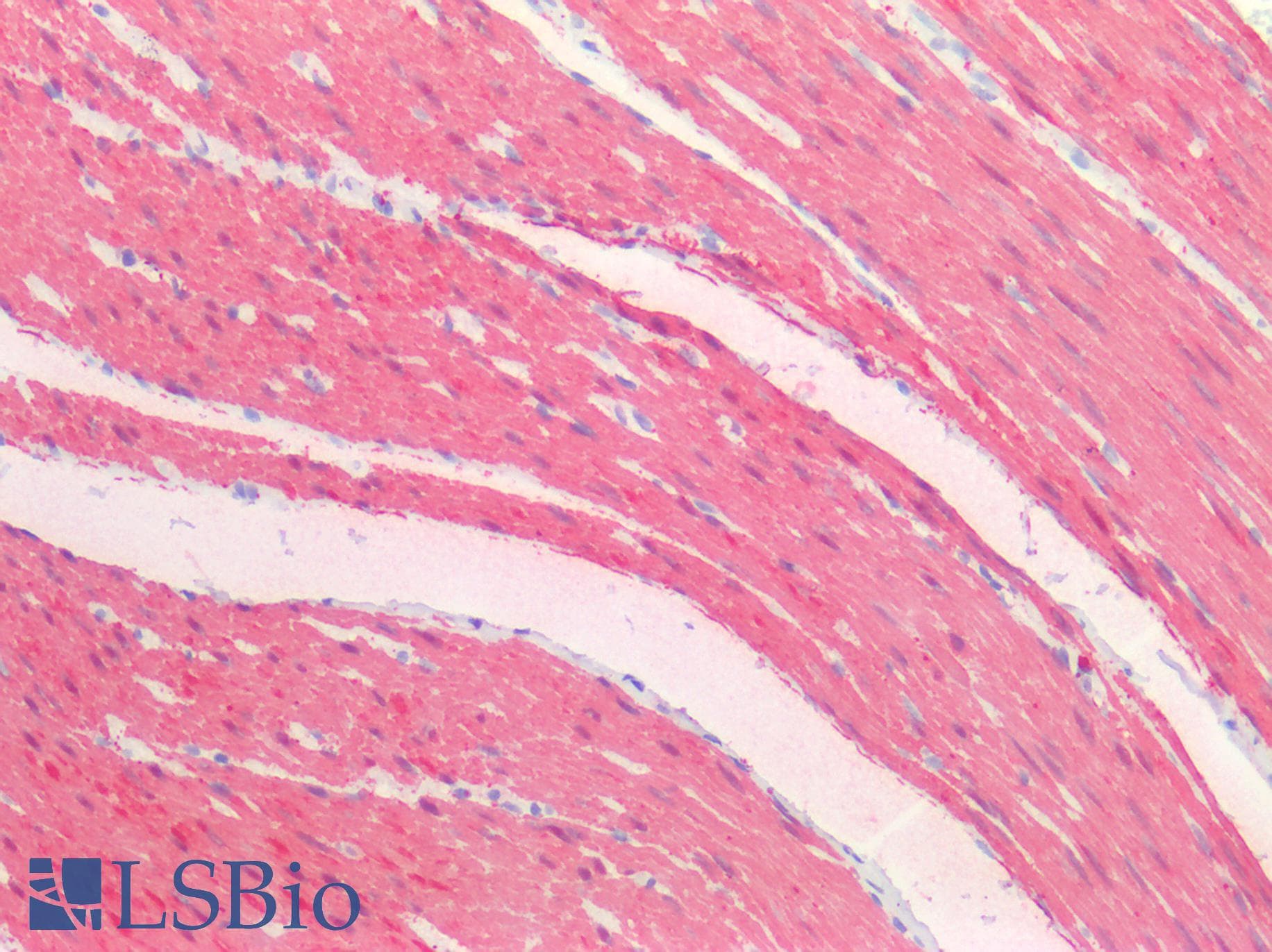 IHC-plus™ Polyclonal Rabbit anti-Human TAGLN / Transgelin / SM22 Antibody (IHC, IF, WB)
