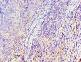 GRK6 Antibody (aa1-170)